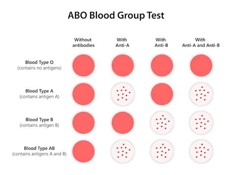 is the abo test hard reddit|Taking my ABO test soon. : r/optometry .